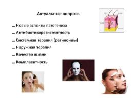 Лікування вульгарних акне
